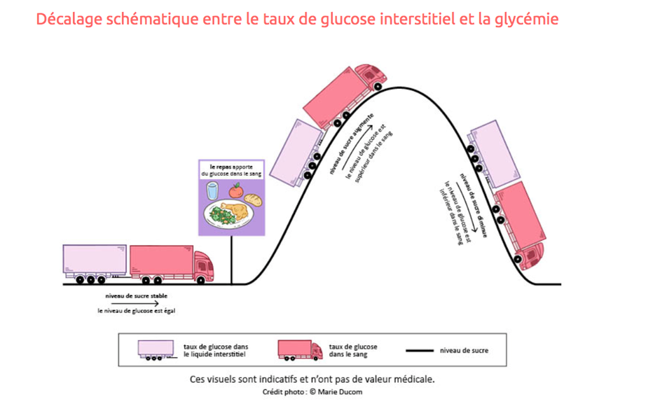 Capteur de Glucose  Appareils pour Mesurer la Glycémie en Continu